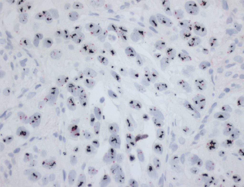 Pathology ASI