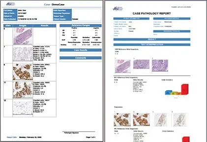 Prepare customized reports including screenshots